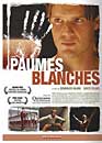  Les paumes blanches 